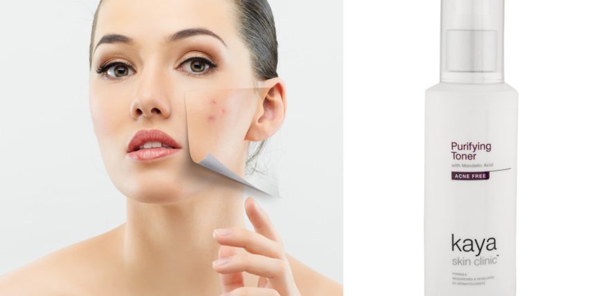 Kaya Acne Free Purifying Toner Review